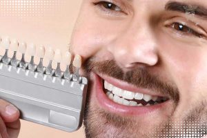 لمینت دندان برای افراد سیگاری
