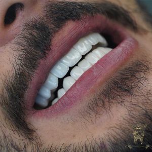 صفر تا صد طراحی لبخند دیجیتال (طرح لبخند) 16 طراحی لبخند دیجیتال
